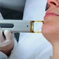 Laser Treatments