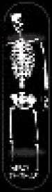 Zero Thomas skeleton